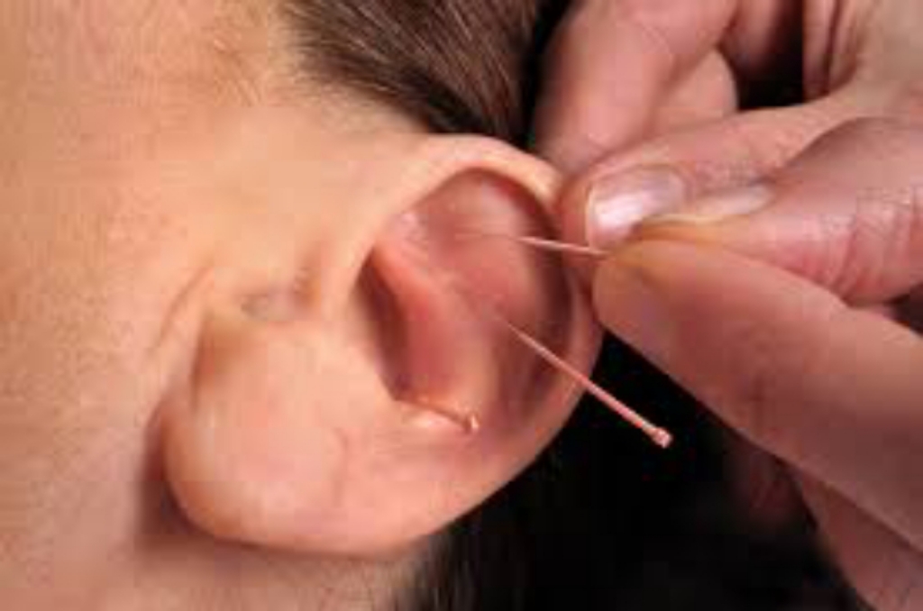 آموزش تخصصی طب سوزنی و طب فشاری