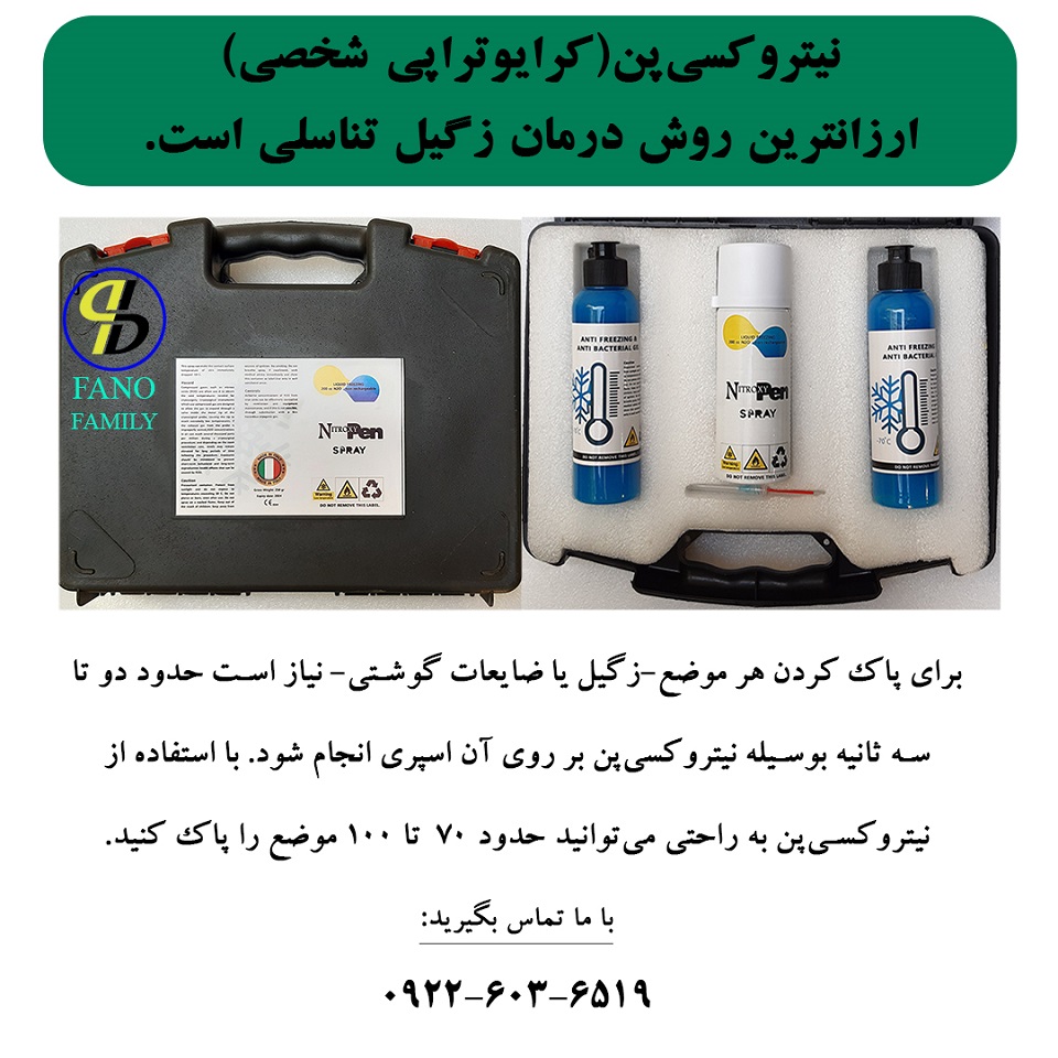 نیتروکسیپن( کرایوتراپی شخصی) ارزانترین روش درمان زگیل تناسلی است