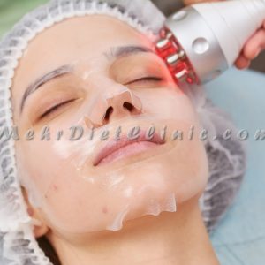 دستگاه لاغری آر اف RF چربی سوز صورت